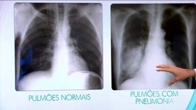 Crianças de 2 e 9 anos morrem com pneumonia em menos de dois dias no interior do Acre