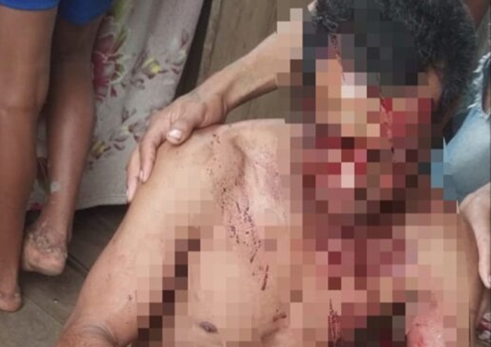 Homem recebe tiro de espingarda na cabeça enquanto tomava uma cachacinha em bar, no Acre