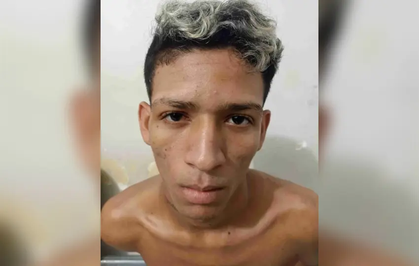 Após matar vigilante em escola, assaltante baleado apresenta melhora e já respira sem ajuda de aparelhos