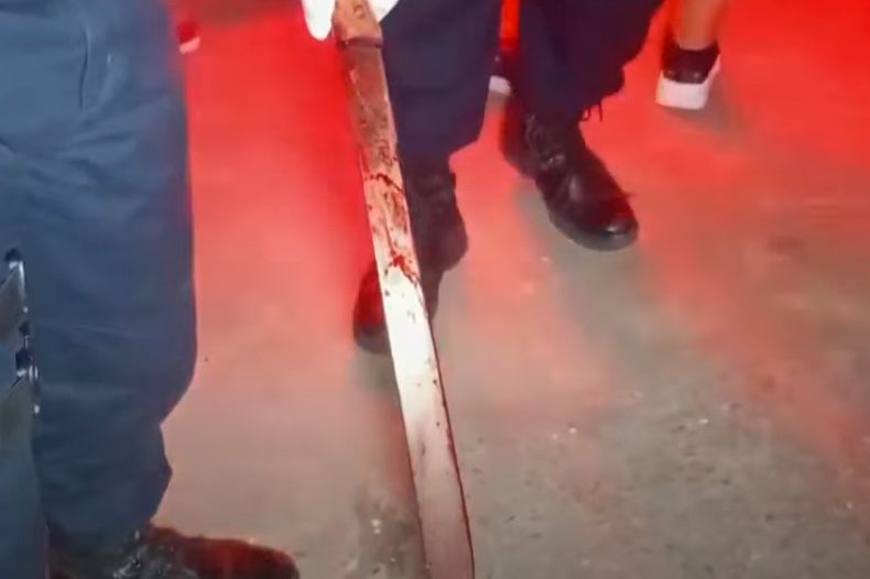 Técnica de enfermagem surta, tenta matar marido a terçadadas e depois se automutila