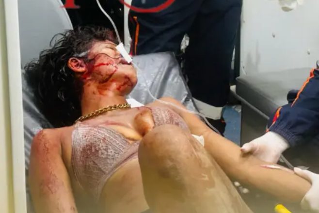 Moradora de rua é atacada por cachorro após invadir residência no bairro da Base, em Rio Branco