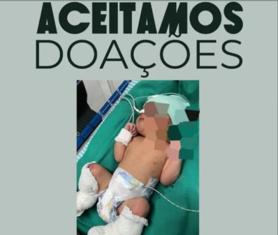 Família de bebê que sofreu queimaduras em hospital do Acre faz campanha para custear estadia em Belo Horizonte