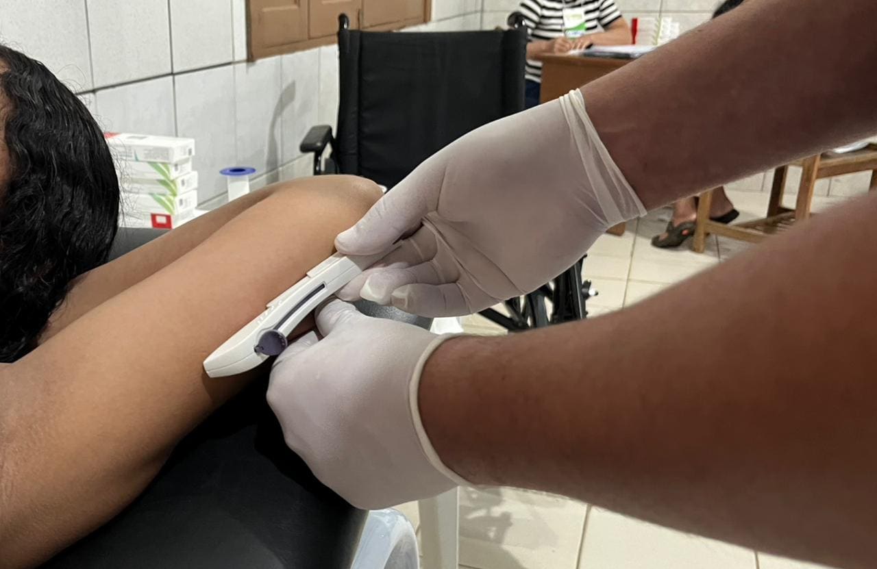 Inédito no Juntos pelo Acre, implante contraceptivo é ofertado a mulheres da regional do Calafate