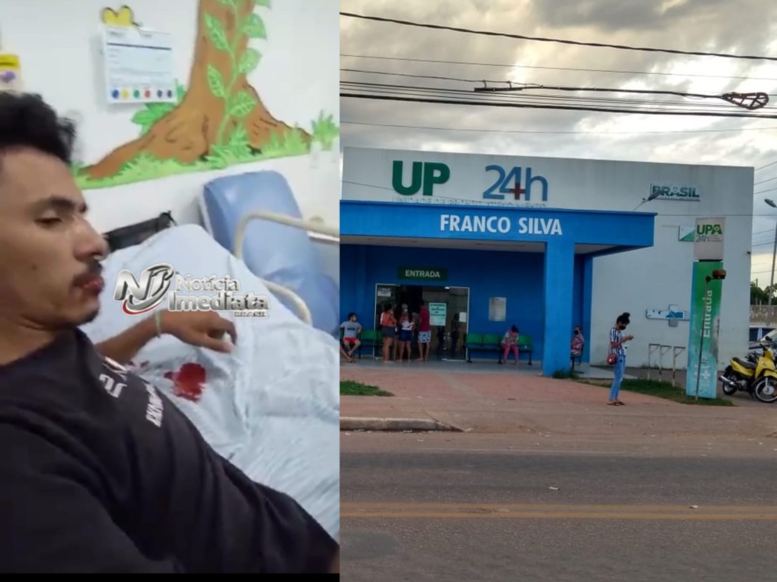 Sesacre se pronuncia após paciente ter nariz espatifado por murros de médico na UPA da Sobral; leia a nota